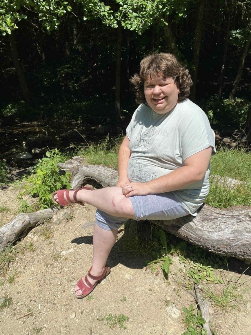 opekacka na ambulantnej forme 22 .jpg